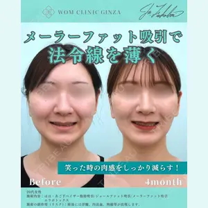 WOM CLINIC GINZA （ワム クリニック ギンザ） 深堀 純也医師の症例