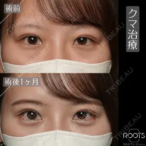 ROOTS Clinic 郭 天元医師の症例