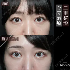 ROOTS Clinic 郭 天元医師の症例