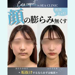 SEA CLINIC（シークリニック） 沼澤 茂医師の症例