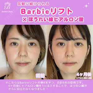 Barbie Clinic みすみ医師の症例