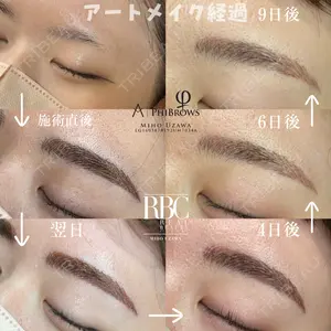 REAL BEAUTY CLINIC 新宿東口院の症例