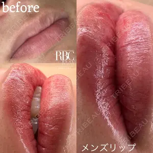 REAL BEAUTY CLINIC 新宿東口院の症例