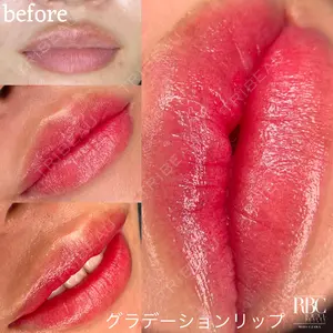 REAL BEAUTY CLINIC 新宿東口院の症例