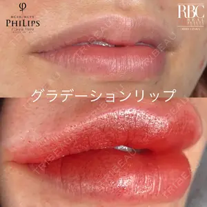 REAL BEAUTY CLINIC 新宿東口院の症例