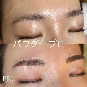 REAL BEAUTY CLINIC 新宿東口院の症例