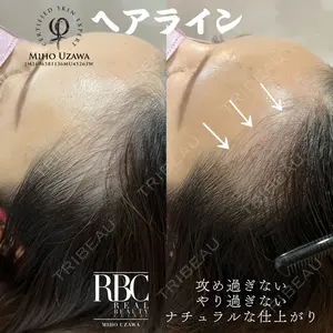 REAL BEAUTY CLINIC 新宿東口院の症例