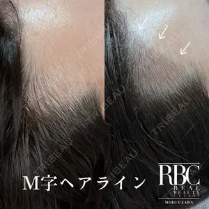 REAL BEAUTY CLINIC 新宿東口院の症例