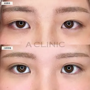 A CLINIC（エークリニック） 池袋院 三橋 克之医師の症例