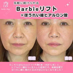 Barbie Clinic みすみ医師の症例