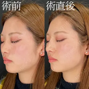HAAB×DREAM BEAUTY CLINIC 大阪梅田院 柏木 太雅医師の症例