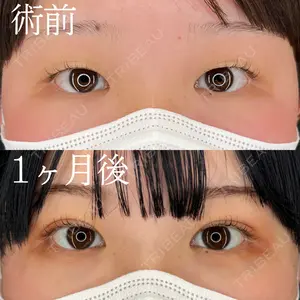 HAAB×DREAM BEAUTY CLINIC 大阪梅田院 柏木 太雅医師の症例