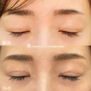 シンデレラ＆ダヴィンチクリニック 宮田 洋佑医師の症例