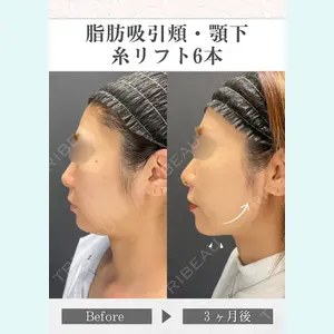 さくらビューティークリニック銀座 富田 さくら医師の症例