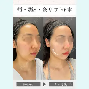 さくらビューティークリニック銀座 富田 さくら医師の症例