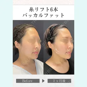 さくらビューティークリニック銀座 富田 さくら医師の症例
