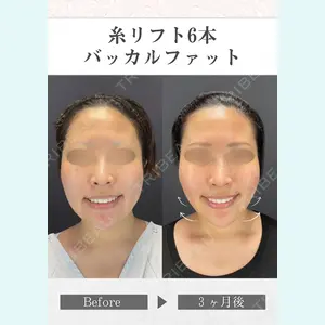 さくらビューティークリニック銀座 富田 さくら医師の症例