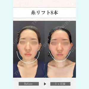 さくらビューティークリニック銀座 富田 さくら医師の症例