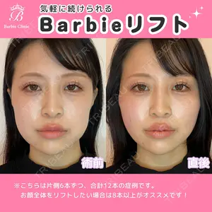 Barbie Clinic みすみ医師の症例