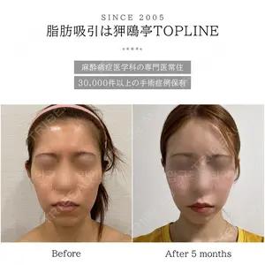 狎鴎亭トップライン医院の症例