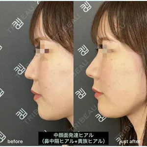 EMMO FACE CLINIC 大阪梅田院 山﨑 冴羅医師の症例