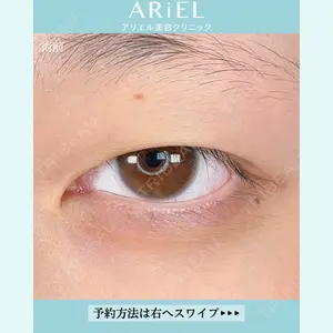 アリエル美容クリニック 大宮院 鈴木　桂介医師の症例