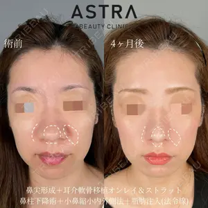 ASTRA BEAUTY CLINIC 塩満 惠子医師の症例