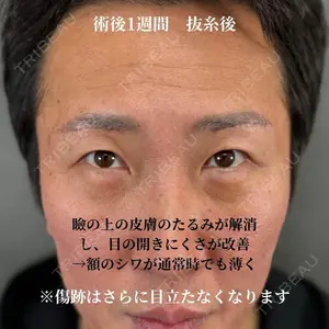 ネビュラクリニック 京都院 岸 大輔医師の症例