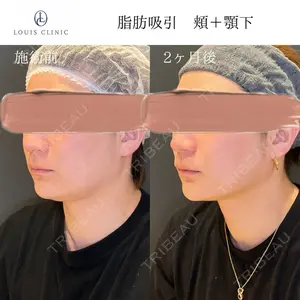 小松 塁医師の症例