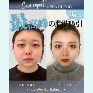 SEA CLINIC（シークリニック） 沼澤 茂医師の症例