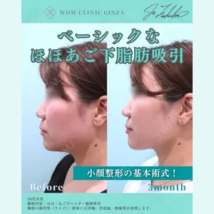 WOM CLINIC GINZA （ワム クリニック ギンザ） 深堀 純也医師の症例