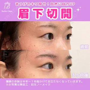 Barbie Clinic みすみ医師の症例