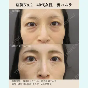 お茶の水美容形成クリニック 吉井 健吾医師の症例