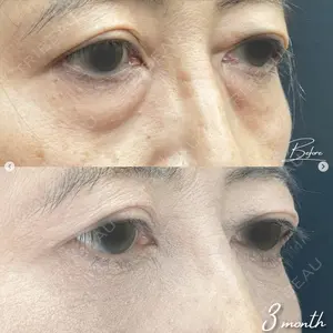 湘南美容クリニック 浜松院の症例