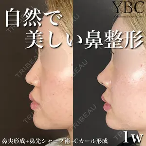 YBC横浜美容外科 大宮院の症例