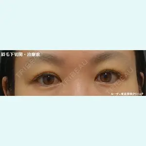 ルーチェクリニック 銀座院 加藤晴之輔医師の症例