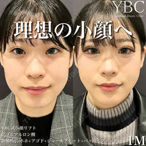 YBC横浜美容外科 大宮院 磯村 亮輔医師の症例