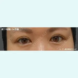 ルーチェクリニック 銀座院 加藤晴之輔医師の症例