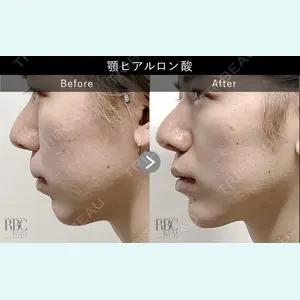 REAL BEAUTY CLINIC 新宿東口院 神谷 佳亮医師の症例