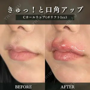 ルラ美容クリニック 千葉院 下川 洋輝医師の症例