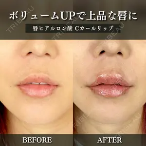 ルラ美容クリニック 千葉院 下川 洋輝医師の症例