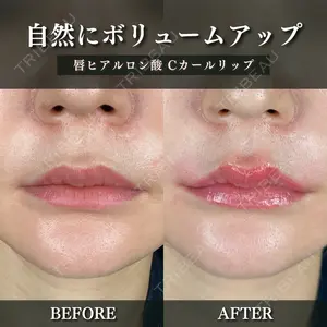 ルラ美容クリニック 千葉院 下川 洋輝医師の症例