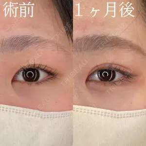 HAAB×DREAM BEAUTY CLINIC 大阪梅田院 柏木 太雅医師の症例