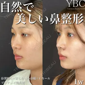 YBC横浜美容外科 大宮院 磯村 亮輔医師の症例