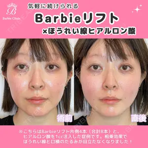 Barbie Clinic みすみ医師の症例