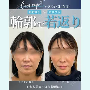 SEA CLINIC（シークリニック） 沼澤 茂医師の症例