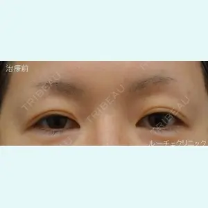ルーチェクリニック 銀座院 加藤晴之輔医師の症例