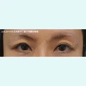 ルーチェクリニック 銀座院 加藤晴之輔医師の症例