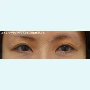 ルーチェクリニック 銀座院 加藤晴之輔医師の症例