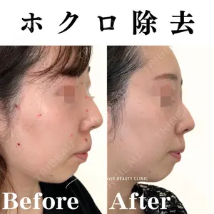 Mavie Beauty Clinic （マヴィービューティークリニック）の症例